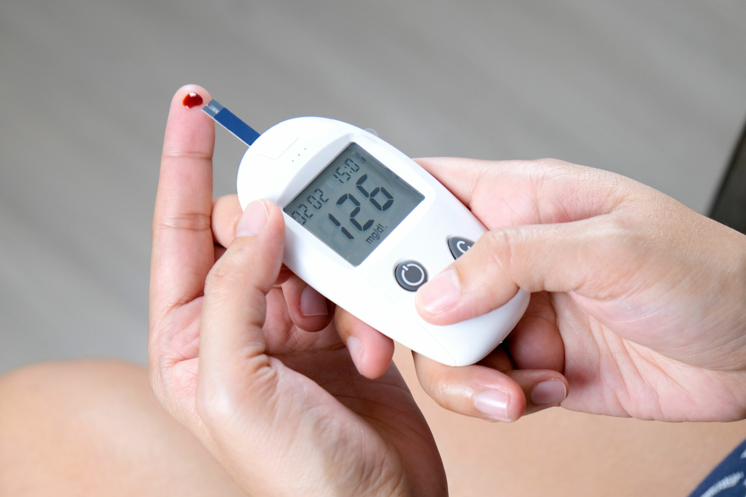 Cholesterin runter, Blutzucker rauf – Statine fördern Diabetesrisiko