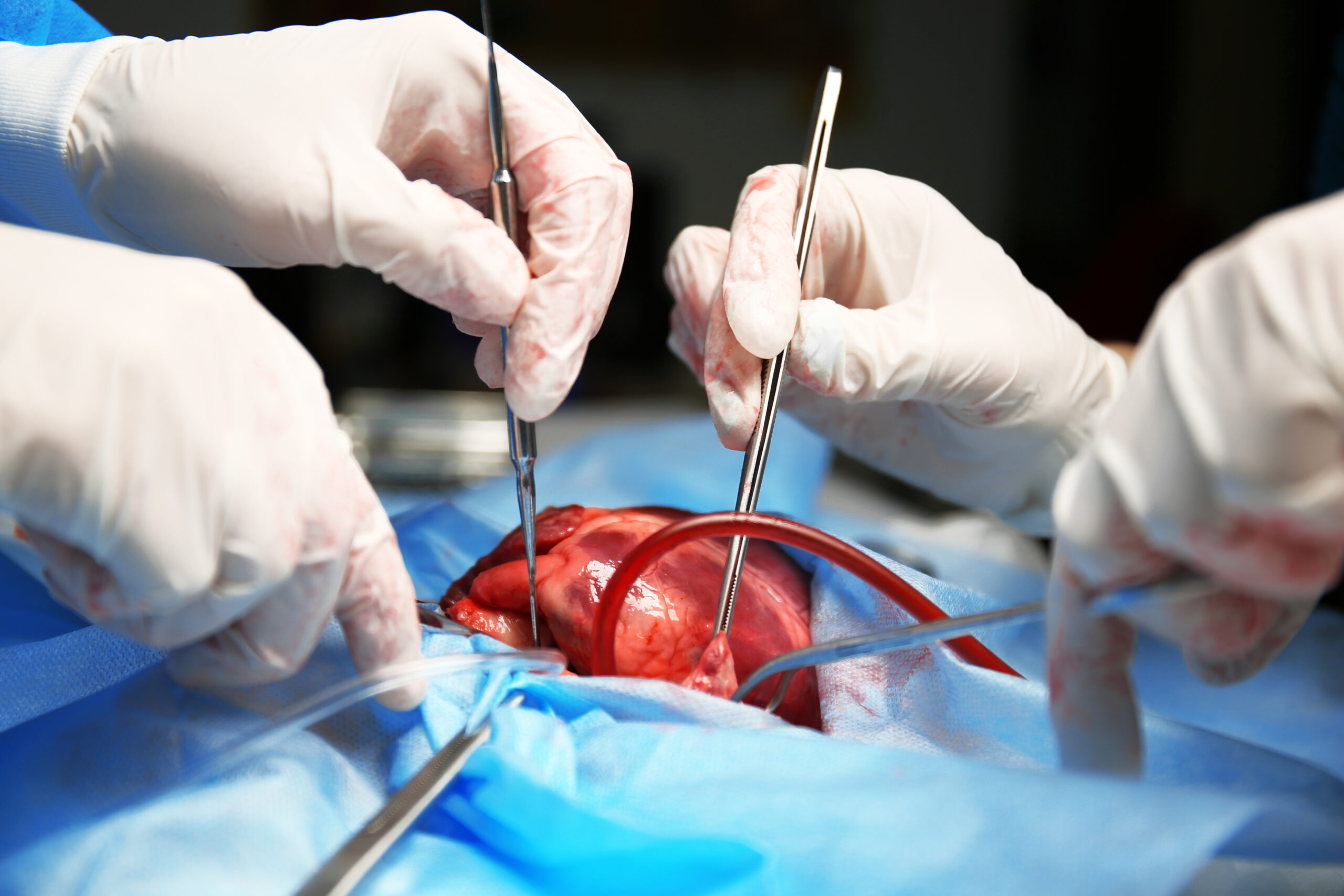 Neue Herzklappenprothese an Uni Wien entwickelt
